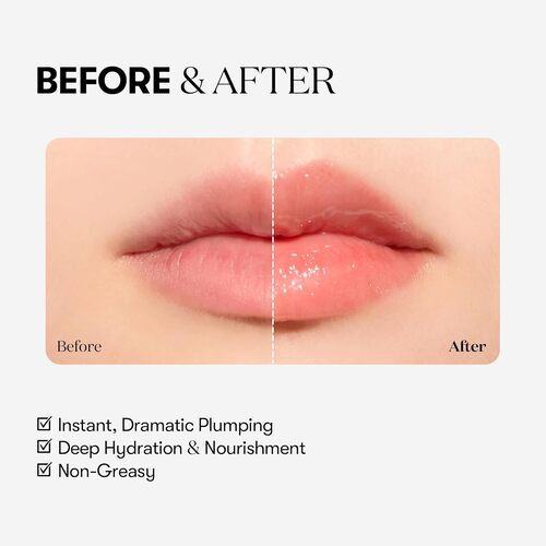VT Cosmetics Reedle Shot Lip Plumper Expert
